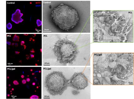 Bild von: Liverani L, et al., Electrospun patterned porous scaffolds for the support of ovarian follicles growth: a feasibility study. Wissenschaftliche Berichte. 2019; 9. doi: 10.1038 / s41598-018-37640-1, dieser Artikel steht unter einer Creative Commons Attribution 4.0 International License http://creativecommons.org/licenses/by/4.0/.