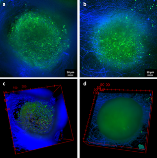 Towards entry "Our paper on electrospun scaffolds for ovarian follicles infiltration, published in PLOS ONE."