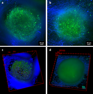 Konfokale Mikroskopiebilder der Follikel innerhalb der Gerüste (a, c) PCL und (b, d) PCL / Gelatine. Grüne Punkte entsprechen lebenden Zellen, blaue Fasern repräsentieren das elektrogesponnene Netz und im Follikel das Vorhandensein einzelner Zellen. Schnappschüsse der 3D-Ansicht sind in (c, d) angegeben. Maßstabsbalken 50 μm. (Ursprünglich unter einer Creative Commons-Lizenz (BY 4.0) in PLOS ONE veröffentlicht).
