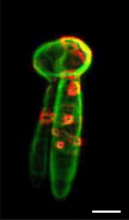 Towards entry "Our article “Re-engineering Artificial Neoplastic Milieus: Taking Lessons from Mechano and Topobiology” published in: Trends in Biotechnology."